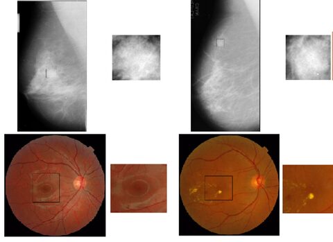 Figure from: Detection and discrimination of disease-related abnormalities based on learning normal cases